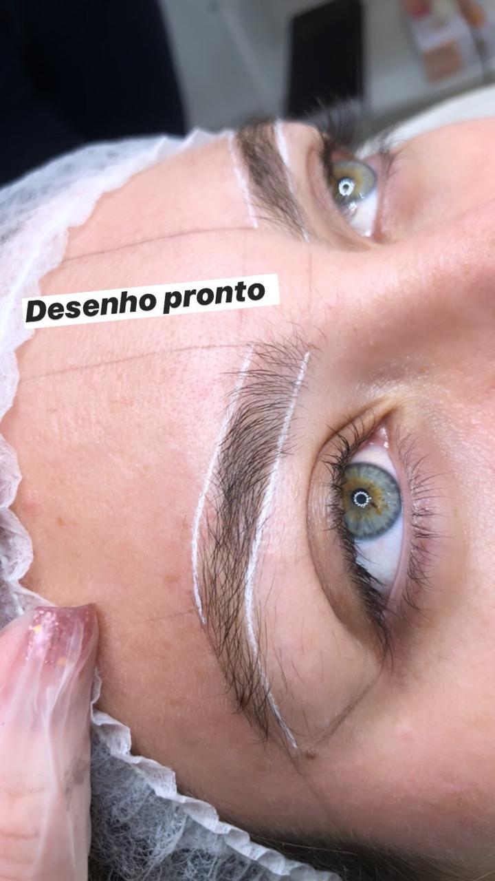 procedimento
