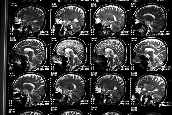 cerebro.jpg